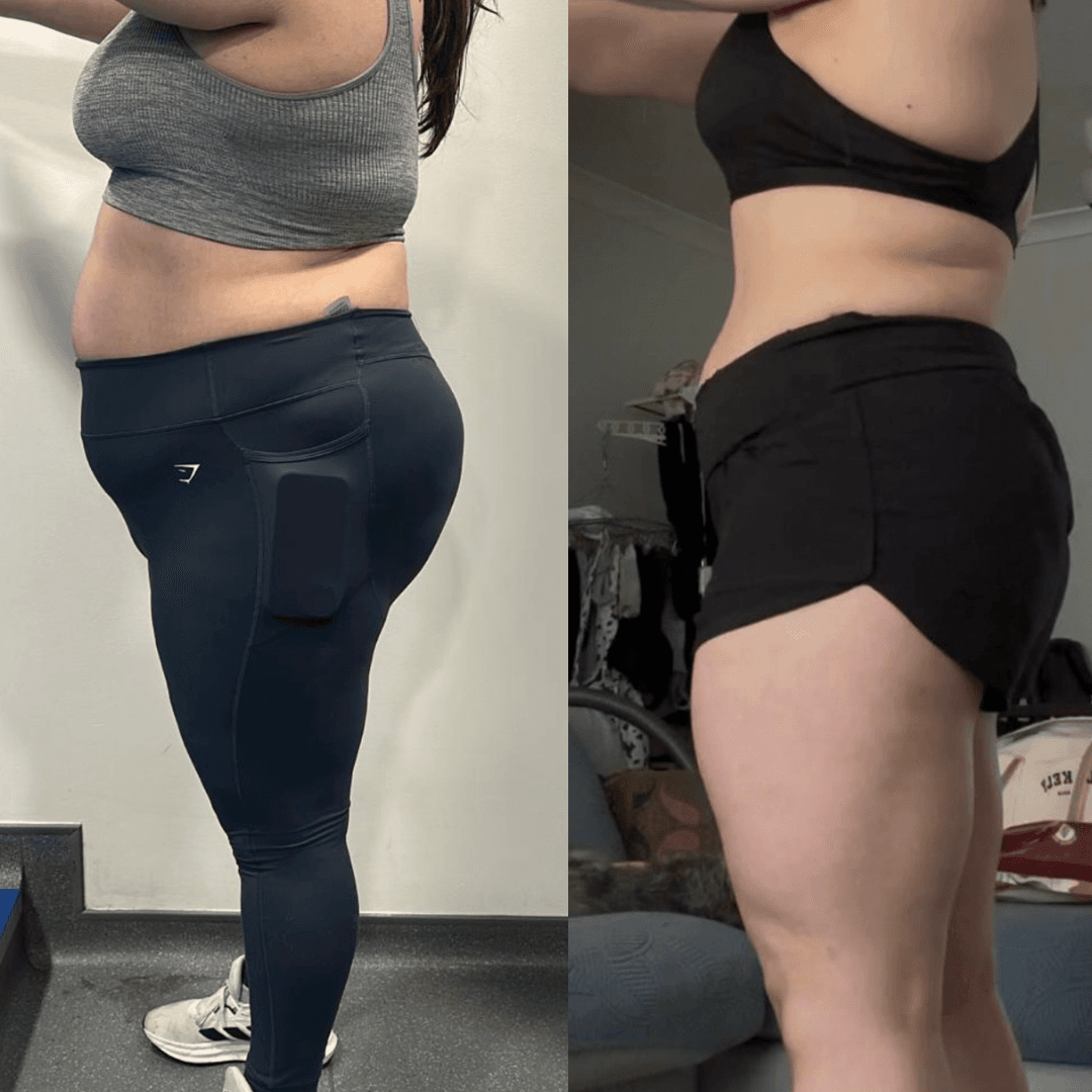 Side-by-side comparison showing a woman's weight loss transformation from a larger to a slimmer physique.